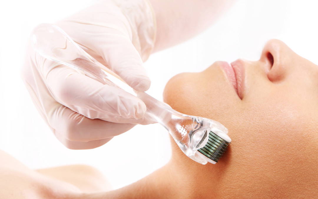 Acne Scar Treatment Leeds