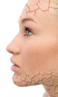 Light Therapy for Skin Problems, Medifine Leeds