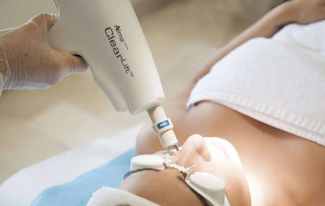 ClearLift Laser Leeds