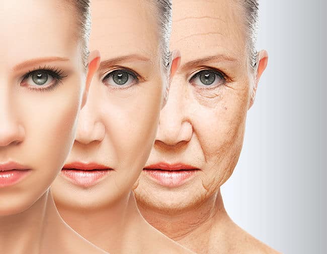 Wrinkles – Causes and Treatments